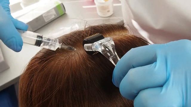Онлайн мастер-класс: Работа с волосистой частью головы, мезопрепаратом Triho от Dermagenetic смотреть онлайн