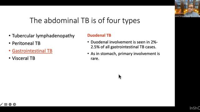 Abdominal Tuberculosis: An ongoing saga (Part-3: Types and Clinical Presentation) смотреть онлайн