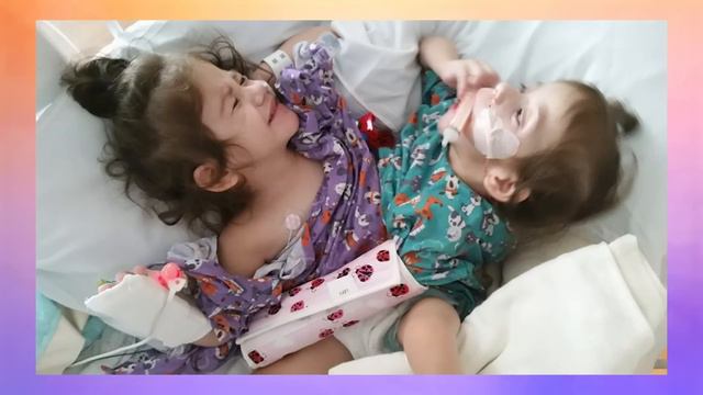 Conjoined Sisters Born As One, Now Thriving As Two | BORN DIFFERENT смотреть онлайн