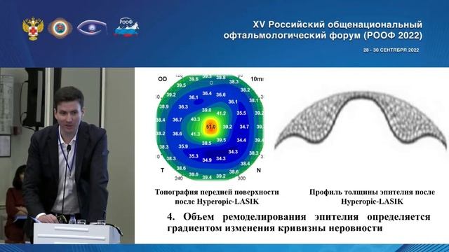 4 Эпителий роговицы и ортокератология. Милаш С В Москва смотреть онлайн
