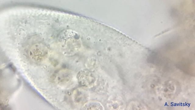 Питание инфузории туфельки \ Feeding ciliate Paramecium caudatum смотреть онлайн
