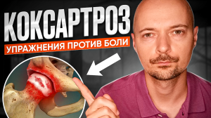 Упражнения против боли в тазобедренном суставе. Лечение коксартроза.