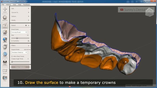 [Mesh mixer + i500] Making dental shell temporary bridges in meshmixer using scanned impression смотреть онлайн