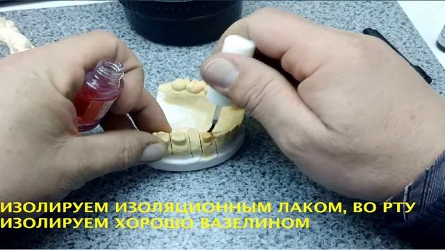 Изготовление временных коронок смотреть онлайн