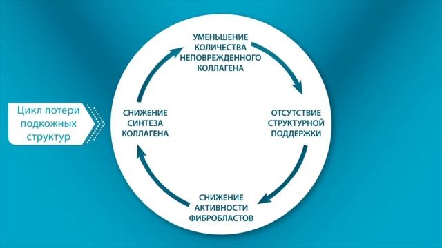 Radiesse - как работает