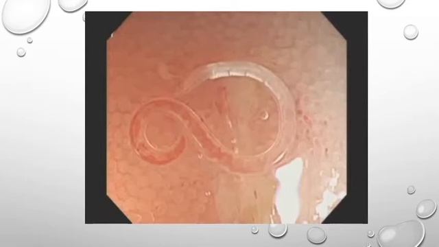 GIT module Parasitology lecture 3 part 1 смотреть онлайн