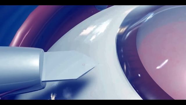 What Happens In Cataract Surgery? | Intraocular Lens (IOL) Implant - 3D Animation смотреть онлайн