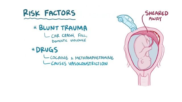Placental abruption - causes, symptoms, diagnosis, treatment, pathology.mp4 смотреть онлайн