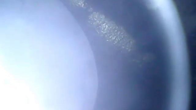 Эндоскопия впускных и выпускных клапанов.mp4 смотреть онлайн