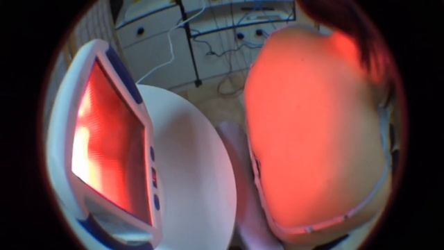 Rehabilitacja Kolno Vitalmed- zabiegi naświetlające Solux.mpg смотреть онлайн