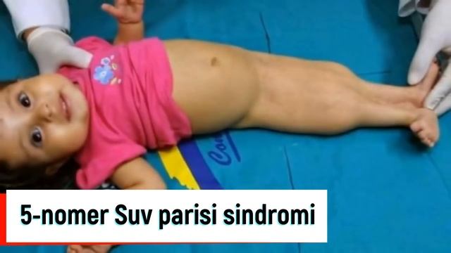 BULARGA NİMA BO'LDİ? MUTATSİYAGA UCHRAGAN ODAMLAR TOP 10 / Mutant Odamlar смотреть онлайн