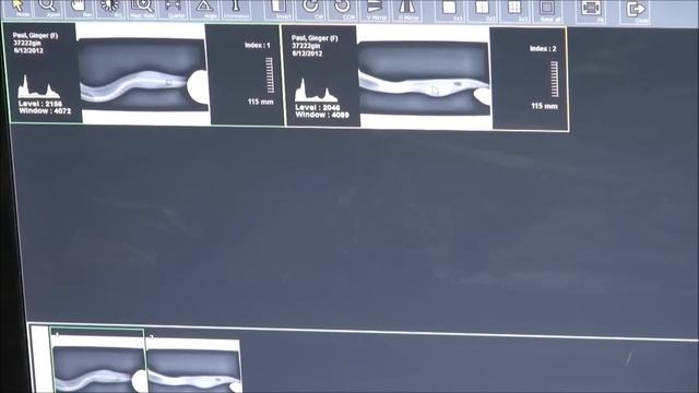 Egg Bound ( Ball Python ) X-Rays смотреть онлайн