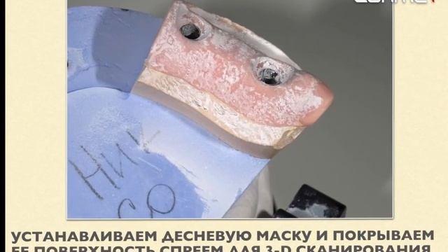 stl смотреть онлайн