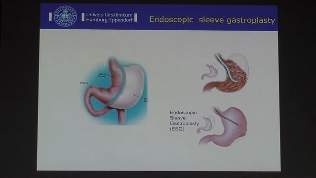 15 Thomas Rosh Current and future Trends in GI Endoscopy смотреть онлайн