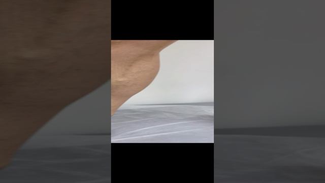 Прием флеболога. Как лечить варикоз? Лечение варикоза оперативное. Флеболог. Флеболог Москва смотреть онлайн