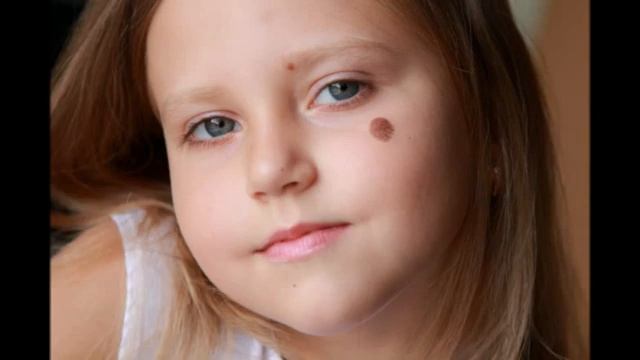 Родинки. Регрессивный гипноз смотреть онлайн