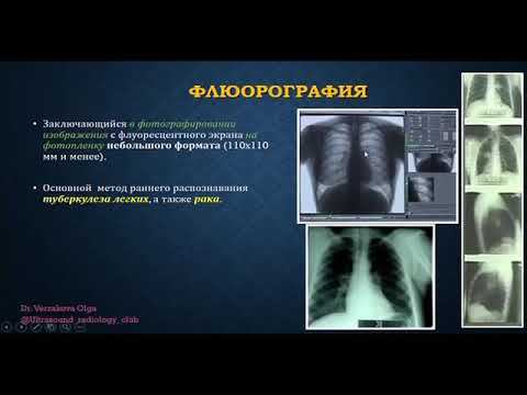 Рентгенологические методы исследований смотреть онлайн