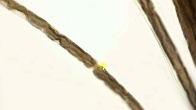 Миелиновые #нервные волокна смотреть онлайн