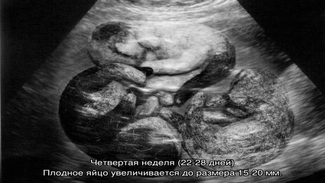 Беременность кошки по неделям: календарь смотреть онлайн