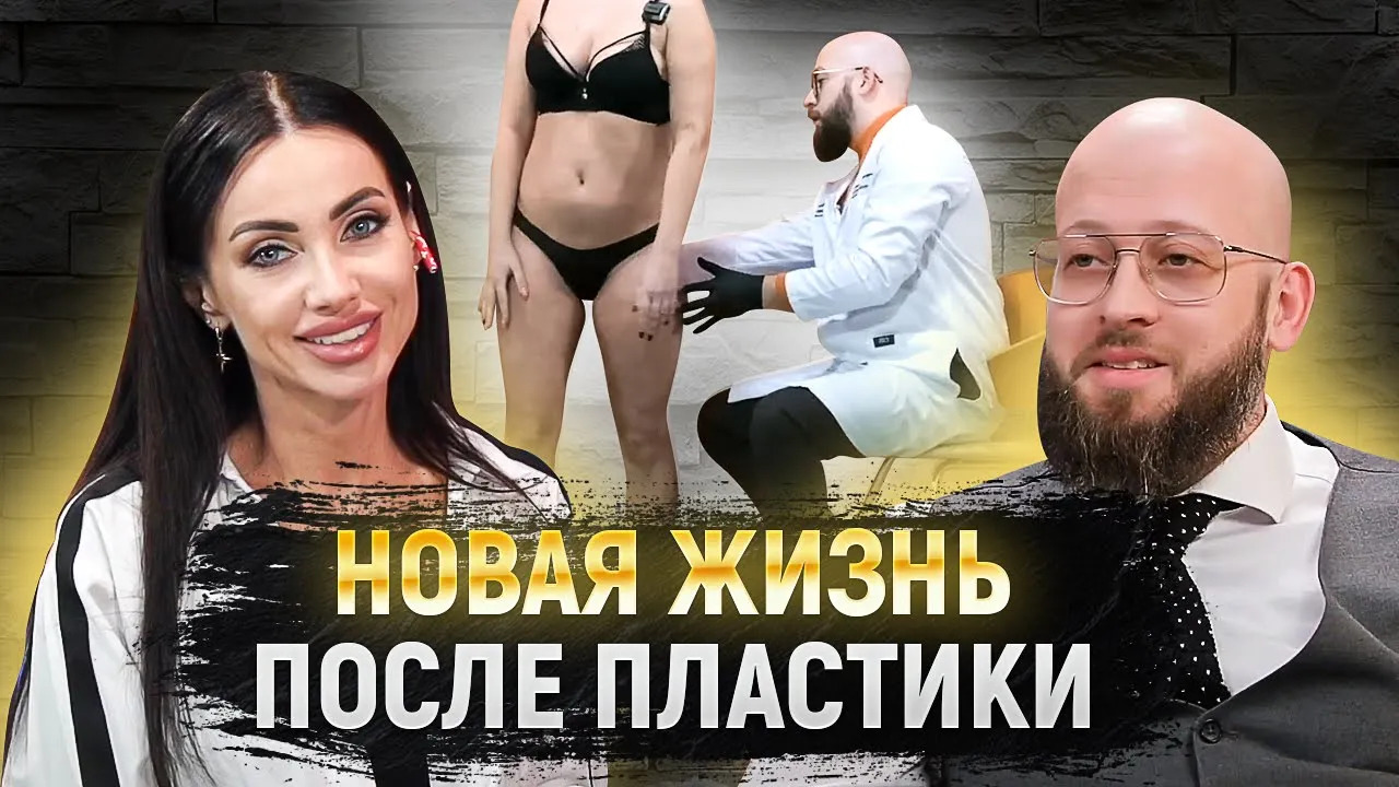 Невероятное преображение с помощью пластической хирургии. Интервью для Шоу "ТОП ПЕРСОНА" смотреть онлайн