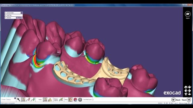 EXOCAD TUTORIAL 2016-Exocad Modellgussmodellation Preview 2 Teil 2- PARTIAL FRAMEWORK смотреть онлайн