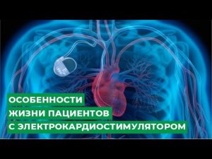 Особенности жизни пациентов с электрокардиостимулятором
