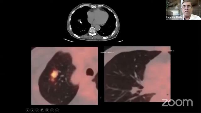Jordan Neurosurgery Grand Rounds смотреть онлайн