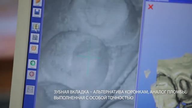 Новый зуб за 2 часа смотреть онлайн