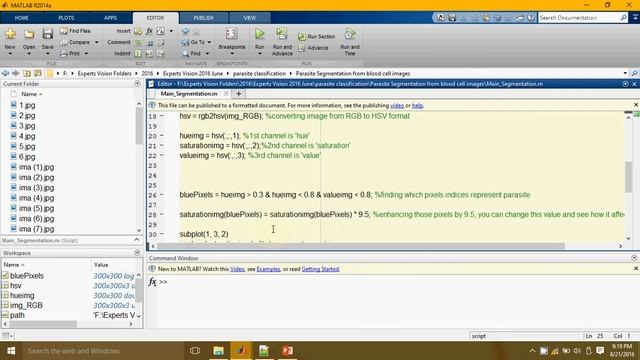 Detection of parasites from images of red blood cells using HSV segmentation смотреть онлайн
