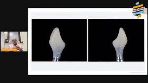 Вебинар А.И.Игумнова "Основы временного протезирования на имплантатах"