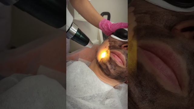 карбоновый пилинг лица пр королева 63к2 центр красоты Аэлита смотреть онлайн