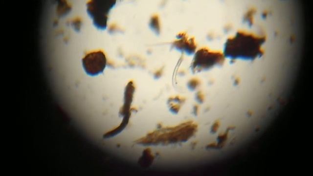 Нематода Nematoda Nematodes увеличение х250 смотреть онлайн