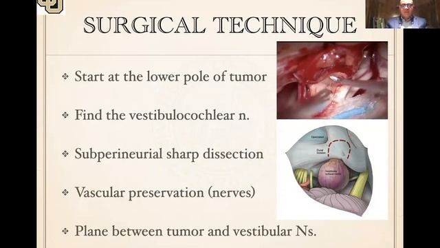 Vestibular Schwannoma The Key to Long-term Functional Preservation by Dr. Samy Youssef смотреть онлайн