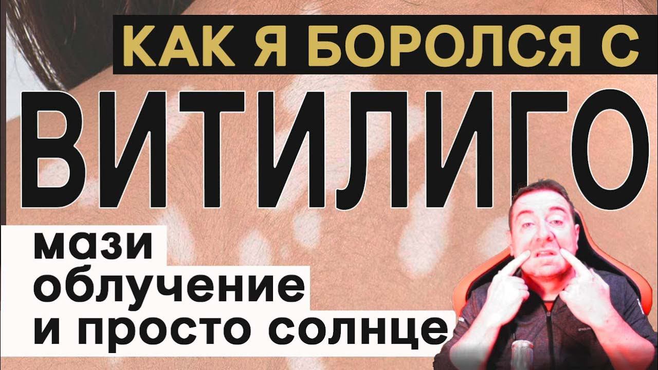 Как я боролся с ВИТИЛИГО и что мне помогло? How did I deal with VITILIGO and what helped me? смотреть онлайн