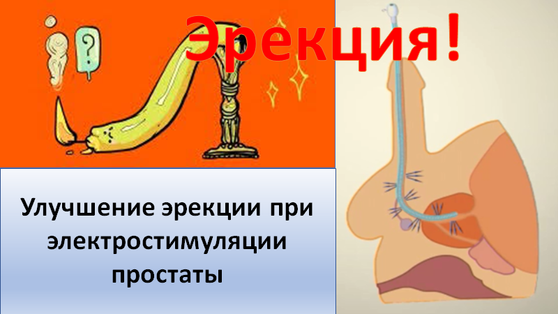 Улучшение эрекции при электротимуляции простаты смотреть онлайн