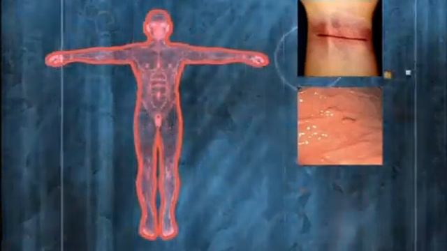 ВИЧ кратко обо всем