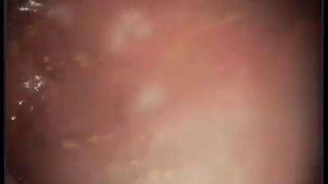 Гастродуоденоскопия у фр бульдога смотреть онлайн