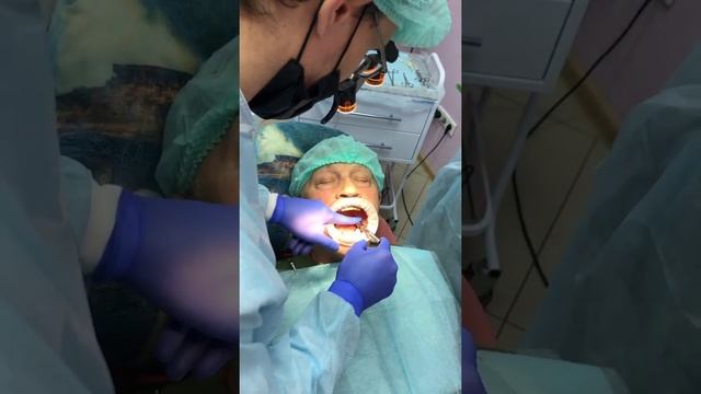 Процесс установки имплантов в стоматологии "уЗубного" смотреть онлайн