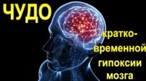 Агрессивная собака. Есть способ... Совет кинолога