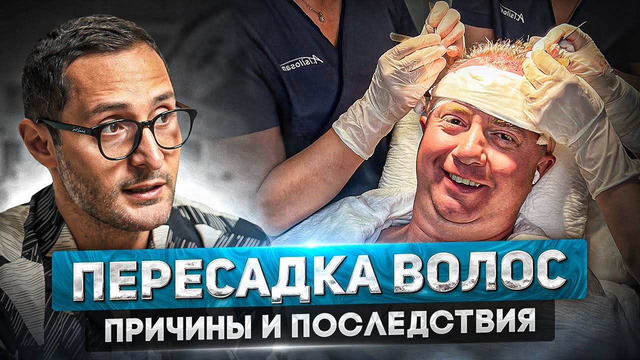 Все о пересадке волос у мужчин. Что делать, если появились залысины?