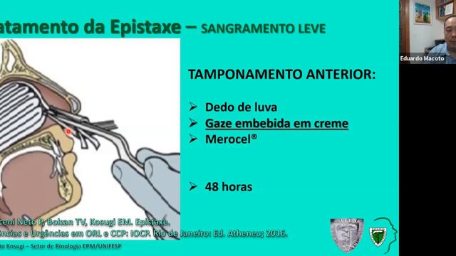 Aula Residência ORL EPM "Epistaxes" com Prof. Eduardo Macoto смотреть онлайн