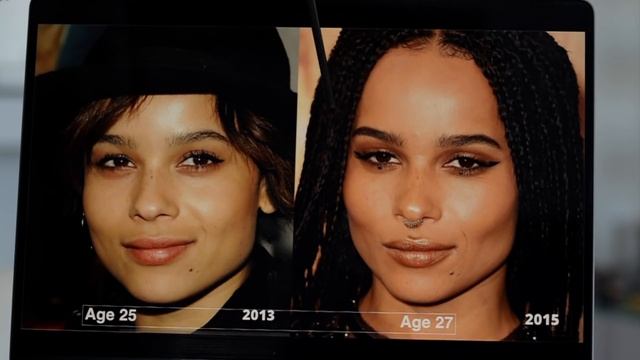 Zoe Kravitz (Catwoman): What happened to her CHEEKBONES? - Surgery Analysis смотреть онлайн