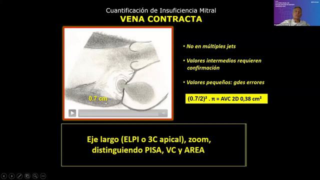 Clase 3: XI CURSO ANUAL DE ACTUALIZACIÓN EN IMAGEN CARDÍACA 2021. смотреть онлайн