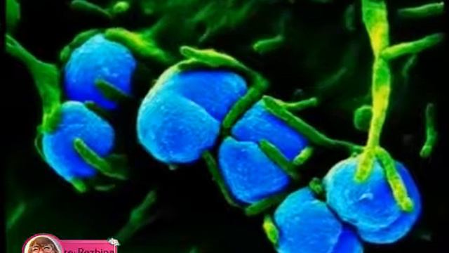 Половые инфекции у женщин смотреть онлайн