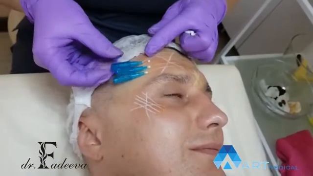 НИТИ toxil смотреть онлайн