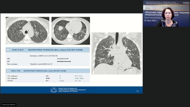 Основы дифференциальной диагностики поражений легких при вирусных инфекциях
