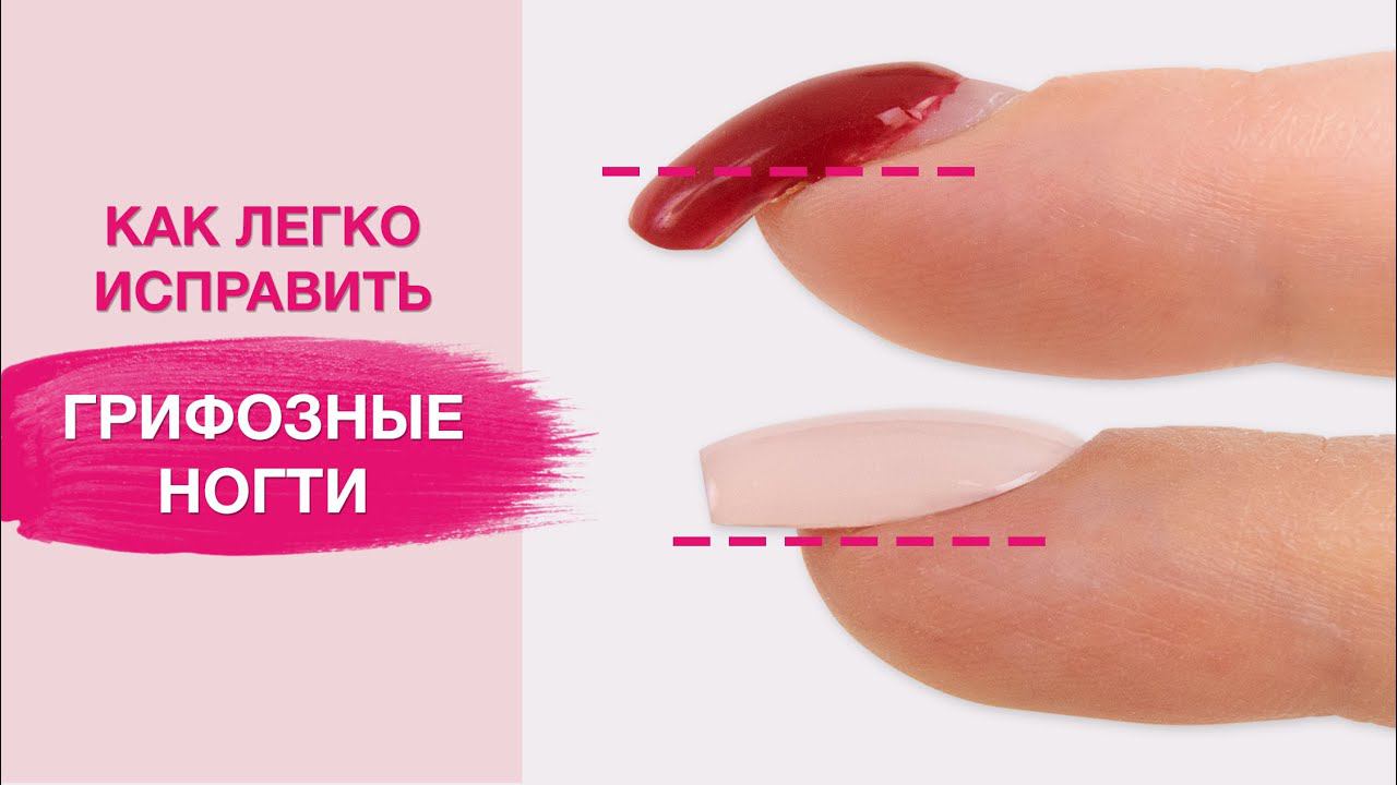 Исправляем КЛЮЮЩИЕ ногти | Выравнивание и укрепление полигелем