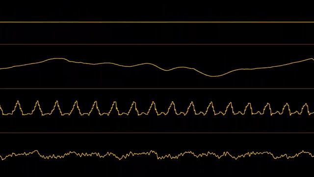 Fleshbrain - “Grave-yard” (Amiga MOD) [Oscilloscope View] смотреть онлайн