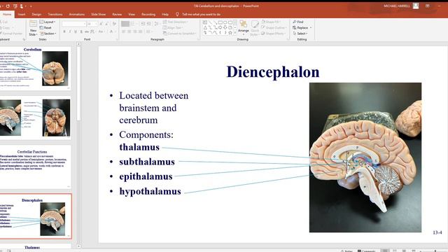 136 Cerebellum and diencephalon смотреть онлайн
