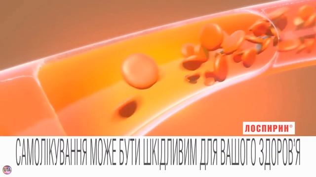 Украинская реклама Лоспирин, 2017 смотреть онлайн